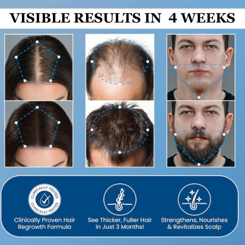 🔥Buy 1 Get 1 Free🔥Advanced Hair Growth Roll-On Serum