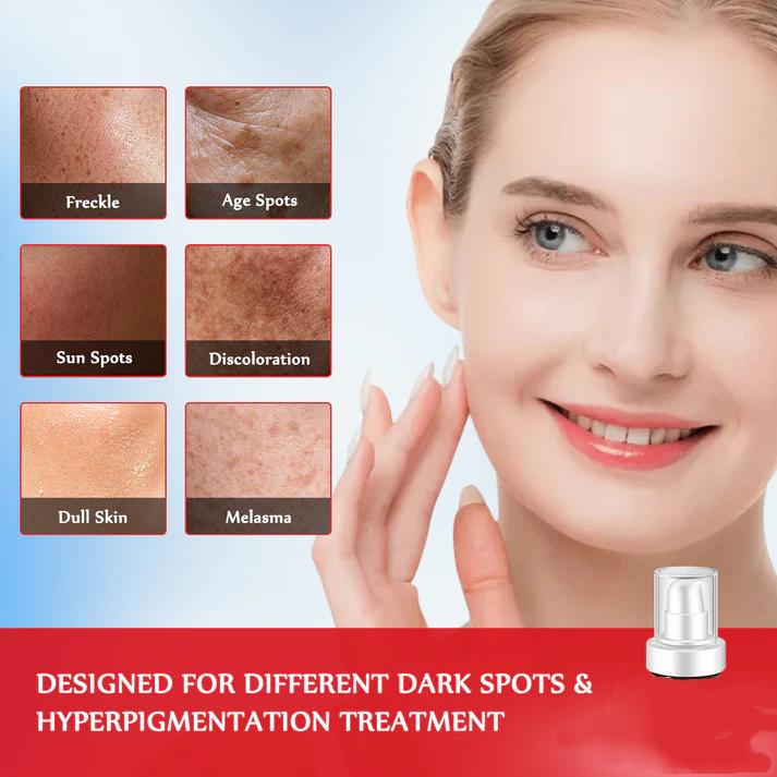 Gentler, Faster Fading, More Affordable — Niacinamide Spot-Reducing Serum / Anti-Aging Cream