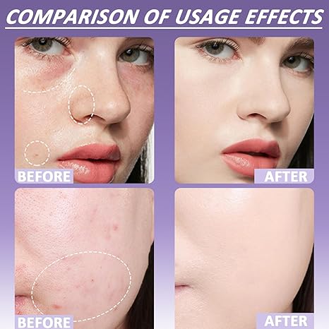 🎉Save Huge – 50% Off 🔥Soft Matte Cream Concealer