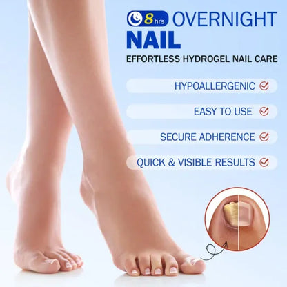Nail care patches, onychomycosis care patches/21 pieces/box