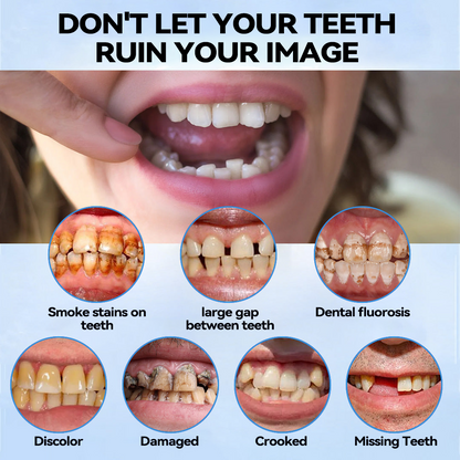 🦷 طقم أسنان سيليكوني قابل لإعادة التبطين (⏰خصم ٧٠٪ لفترة محدودة - آخر ٣٠ دقيقة ⏰) 
