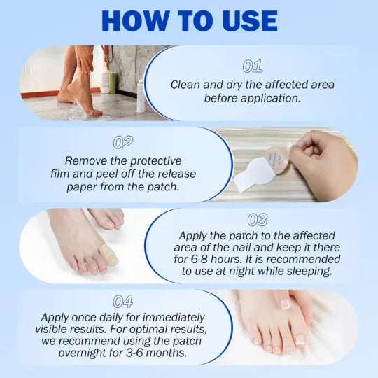 Nail care patches, onychomycosis care patches/21 pieces/box