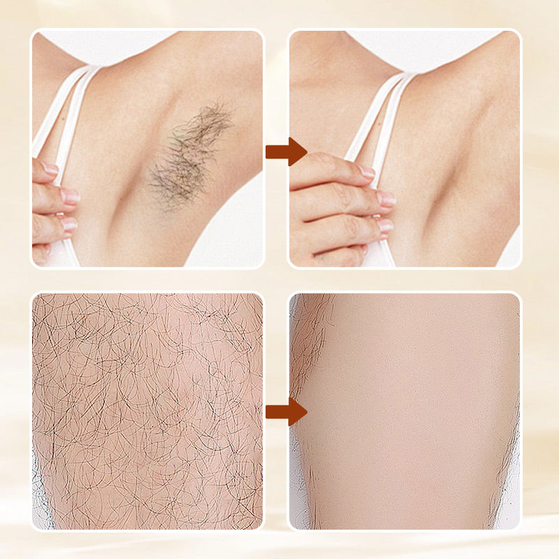 🔥Buy 1 get 1 free🔥🧴Fast Effective Depilatory Cream Skin Friendly