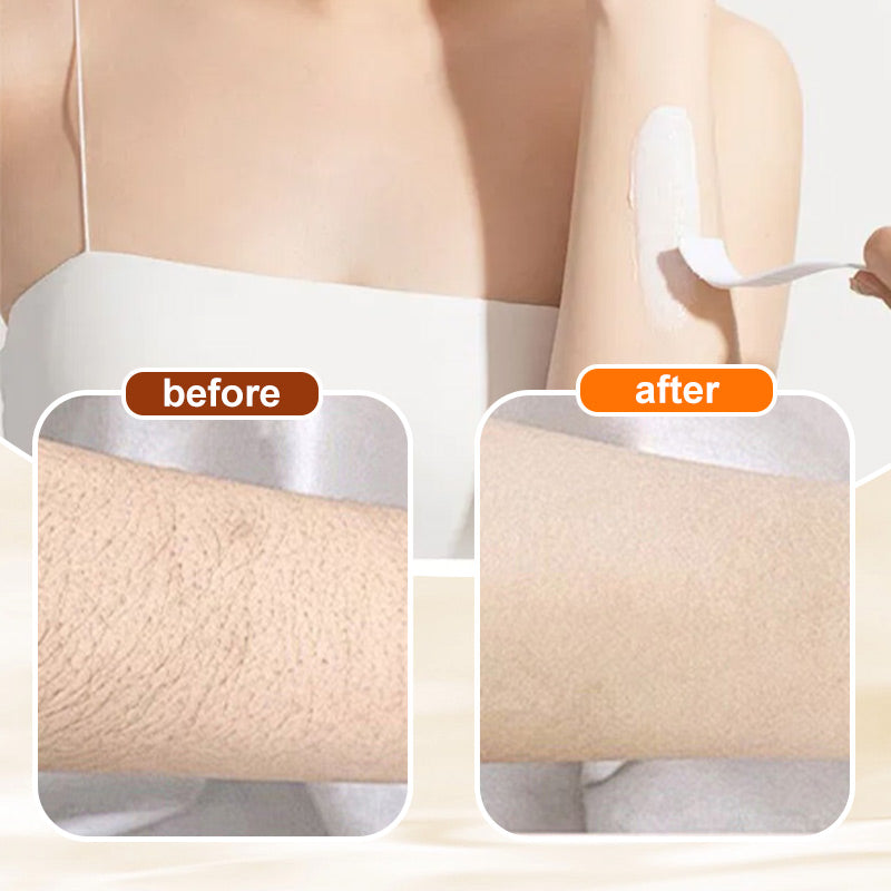 🔥Buy 1 get 1 free🔥🧴Fast Effective Depilatory Cream Skin Friendly